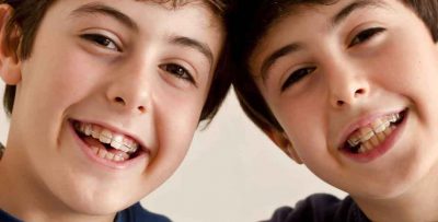 Pediatric dental is one of the essential health benefits on ACA-compliant plans. Does that mean that my insurance will cover braces for my son? photo