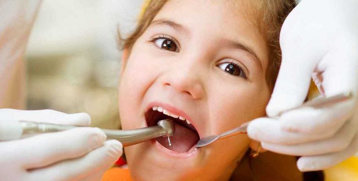 1Dental vsDental Insurance